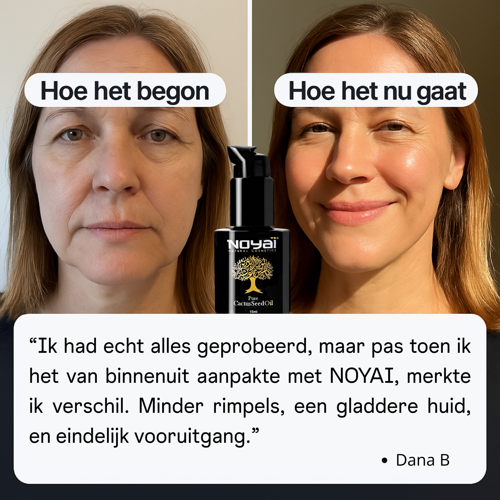 Prickly Pear Seed Oil- 15ml