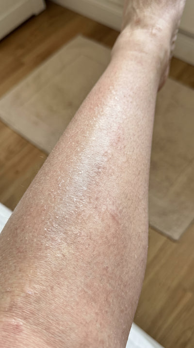 Before - Marleen J.