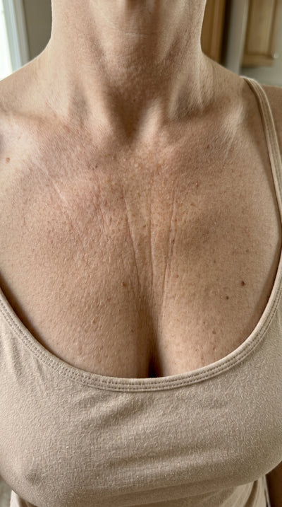 Before - Karin V.