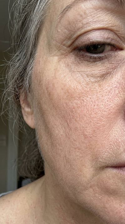 Before - Greetje H